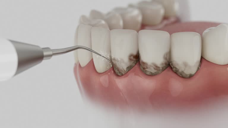 Reliable Dental contractor in Celina, OH by Smile Center Dentistry